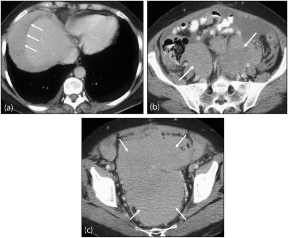 Figure 15