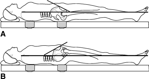 Fig. 2A–B