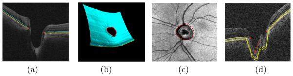 Fig. 1