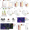 Figure 3. The inhibitory Fc receptor FcγRIIB is highly expressed in the TME. A–F, Flow cytometric analysis of human FcγRs in tumors and lymphoid organs from humanized CTLA-4/FcγR mice. Percentages of expression of the activating FcγRIIIA and the inhibitory FcγRIIB in CD45+ immune cells from MC38 (A), MCA-205 (B), and B16 (C) tumors. Representative histograms and quantification of the mean percentage ± SEM of cells expressing the indicated FcγR are shown. Each symbol represents an individual mouse and data are from one experiment (n = 5–6 mice/model). P values were determined by Mann–Whitney test. Expression levels of the inhibitory FcγRIIB in CD45+ immune cells isolated from tumor-draining lymph nodes, spleens, and tumors from mice bearing MC38 (D), MCA-205 (E), or B16 (F) tumors. Representative histograms and quantification of the MFI ± SEM of FcγRIIB in CD45+FcγRIIB+ cells are shown. Dotted lines indicate Fluorescence Minus One (FMO) control. Each symbol represents an individual mouse and data are from one experiment (n = 5–6 mice/model). P values were determined by Kruskal–Wallis test with Dunn multiple comparison test. G–I, mIF analysis of human FcγRs in human tumors. G, Schematic drawing indicating the cohort of patients and experimental procedure. Resected tumors from patients (n = 14) with HNSCC were analyzed by mIF for CD3, CD68, FcγRIIB, FcγRIIIA, and DAPI (top). Representative image (of 14 samples) showing myeloid cells (CD68, green) expressing FcγRIIB (yellow) and/or FcγRIIIA (red) in a tumor resected from a patient (bottom). Inset shows a higher magnification image of the boxed area with all individual stainings. H, Representative segmentation mask obtained from the original image shown in G and the distinct cell phenotypes analyzed in the study. I, Quantification of the percentage of cells expressing the indicated FcγR in CD68+ myeloid cells (left). Each symbol represents a patient and data indicate means ± SEM. The ratio of FcγRIIIA+ to FcγRIIB+ cells among CD68+ myeloid cells is indicated (right). P value was determined by Mann–Whitney test. *, P < 0.05; **, P < 0.01; ns, not significant. Panel G was created with BioRender.com.