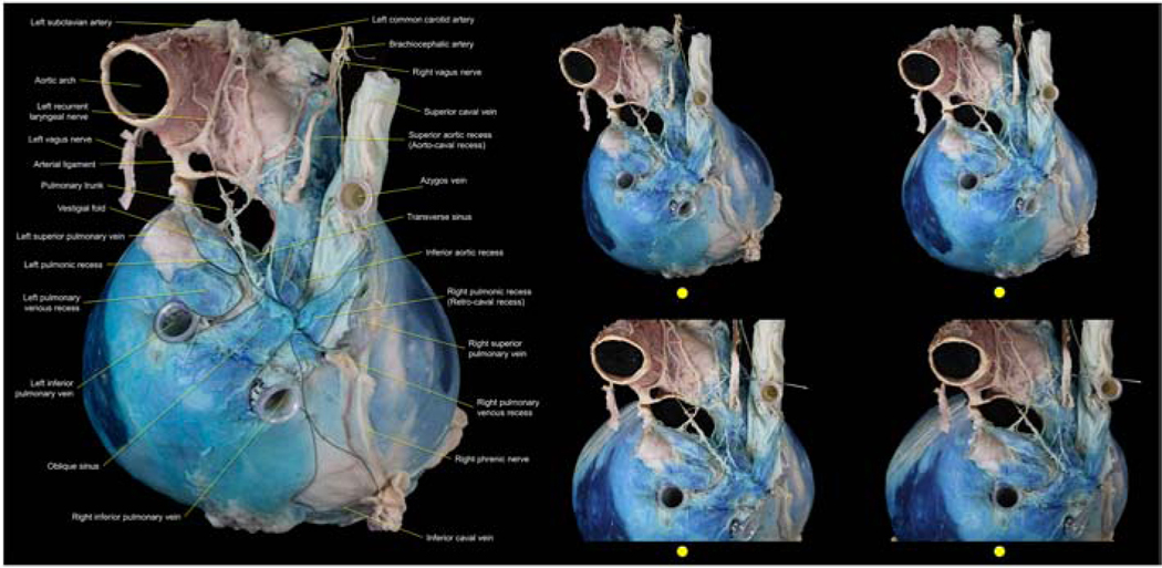 Figure 14: