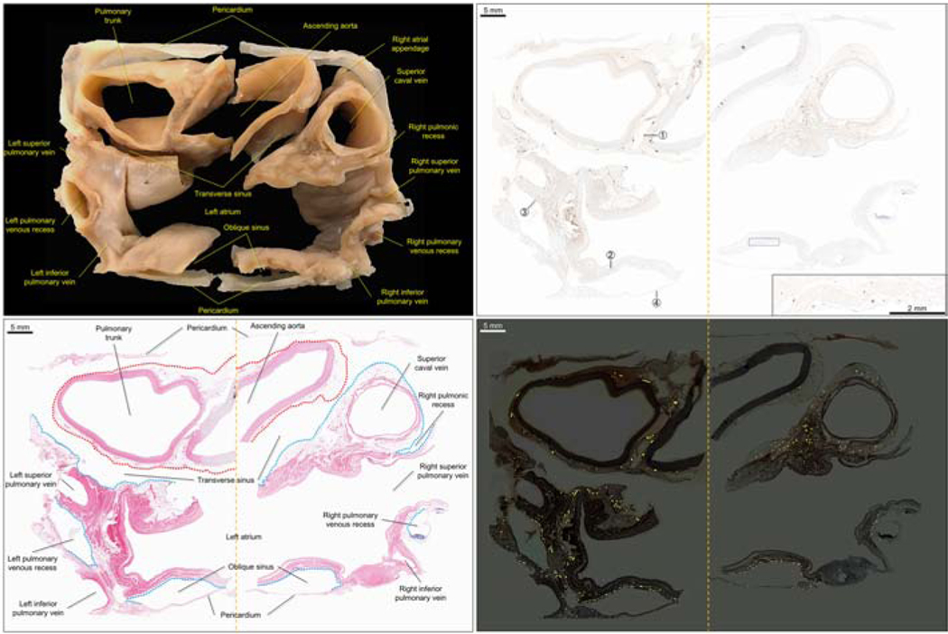 Figure 11: