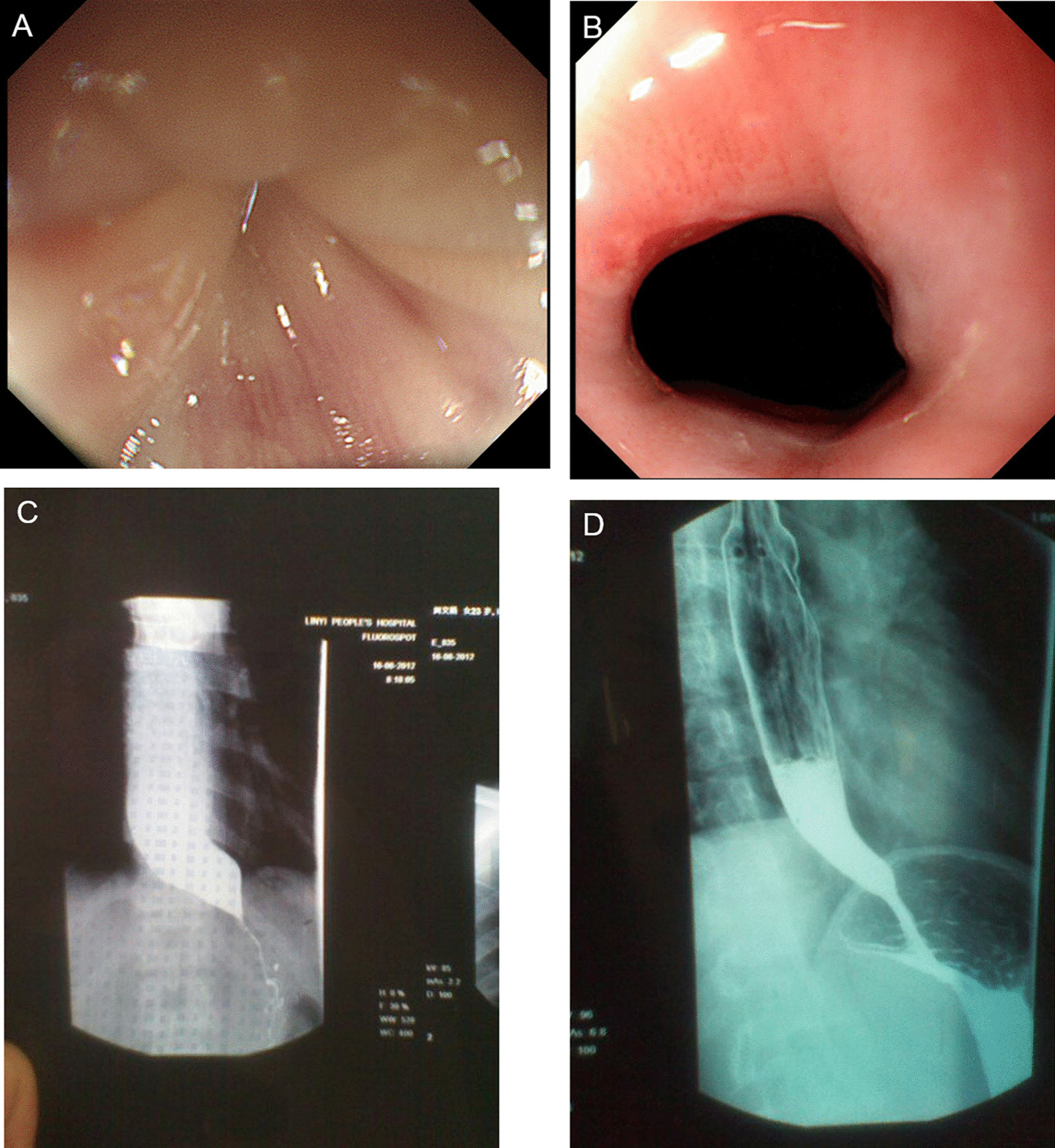 Fig. 4