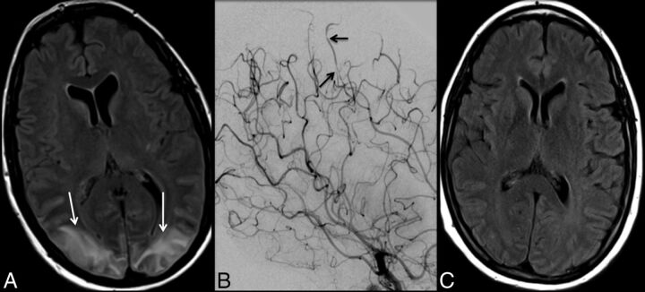 Fig 2.