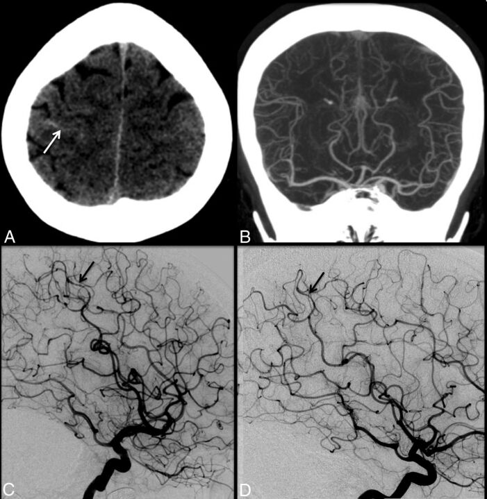 Fig 1.