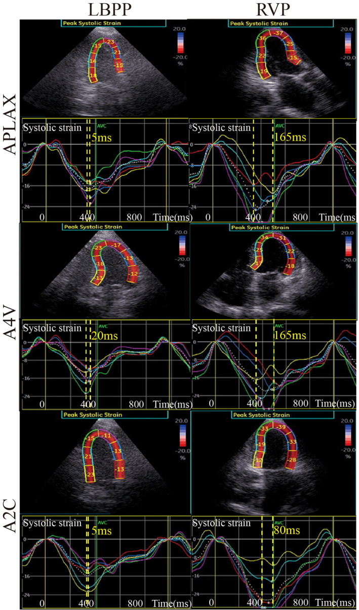 FIGURE 3