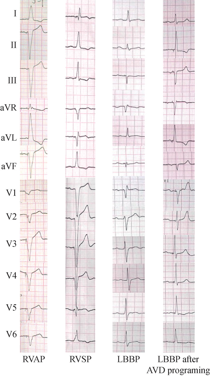 FIGURE 2