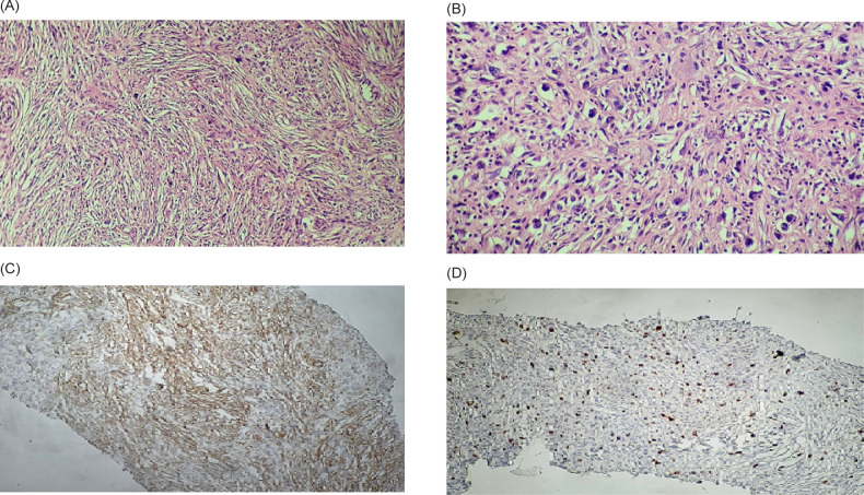 FIGURE 2: