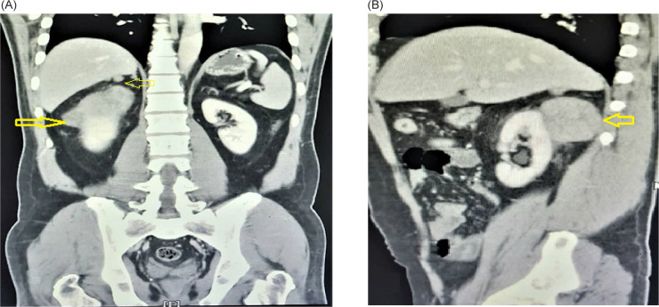 FIGURE 1: