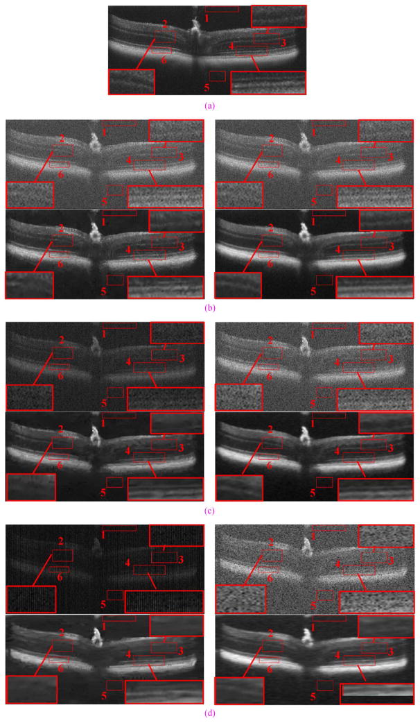 Fig. 11