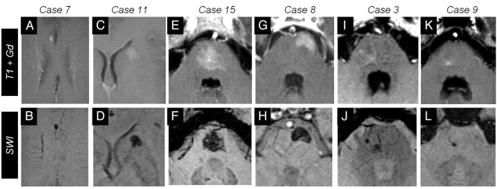 Fig 2.