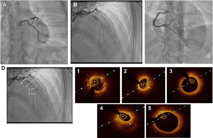 Figure 1