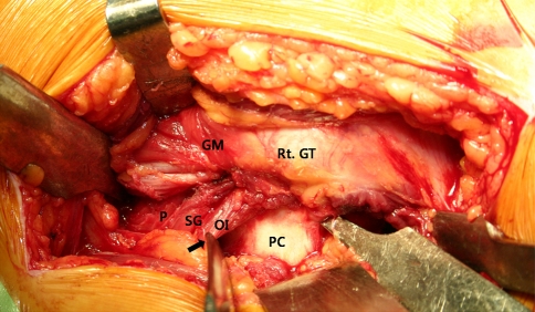 Fig. 1