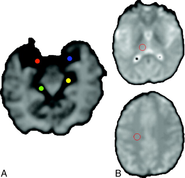 Fig 1.