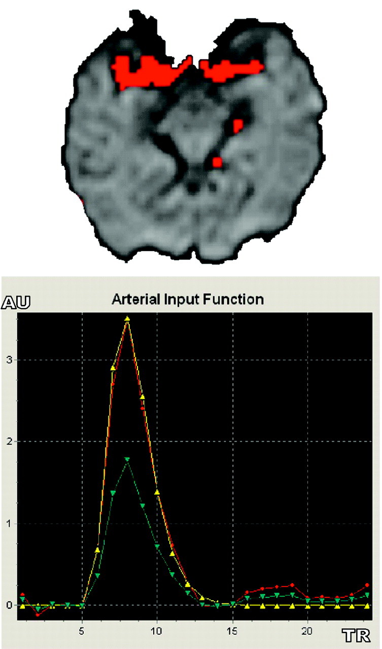 Fig 2.