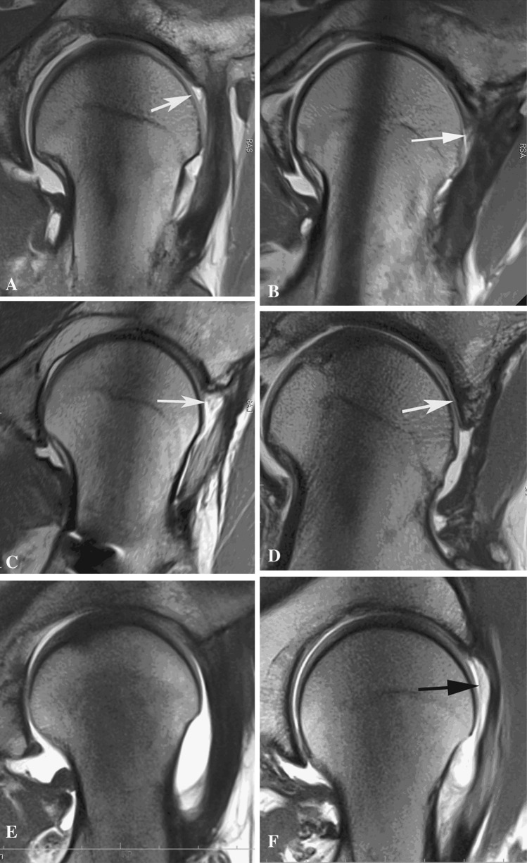 Fig. 1A–G