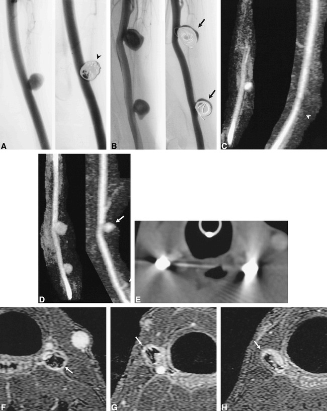 fig 6.