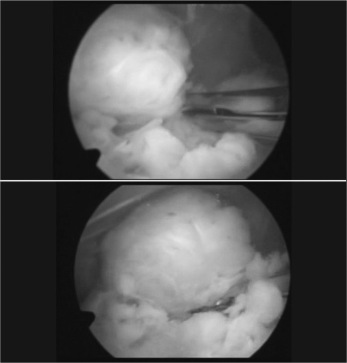 Figure 5 and 6