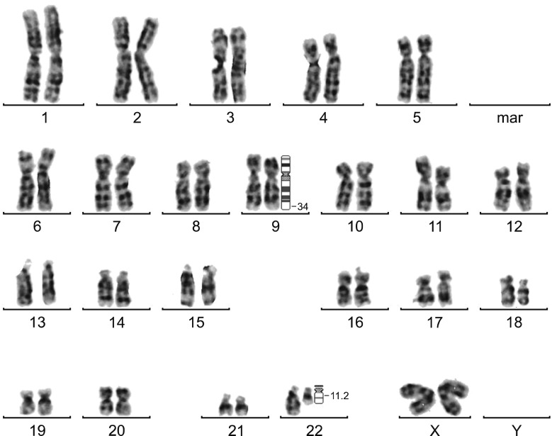 The incidence of atypical patterns of BCR-ABL1 rearrangement and ...