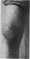 738-1