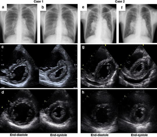 Fig. 1