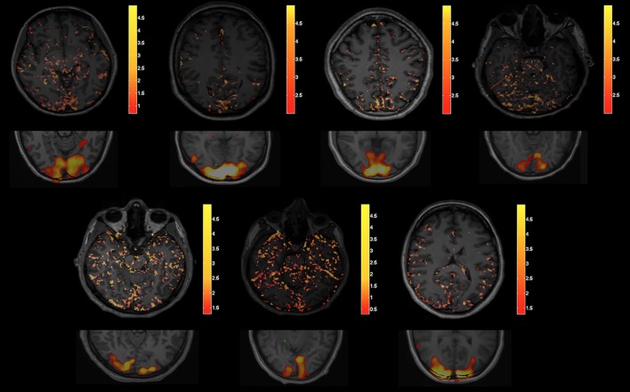 Fig 3