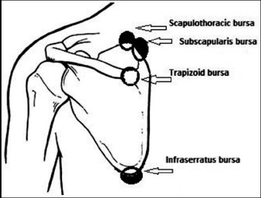 Fig.1