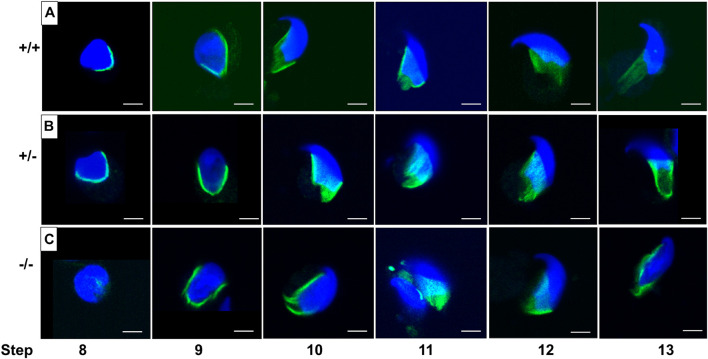 FIGURE 11