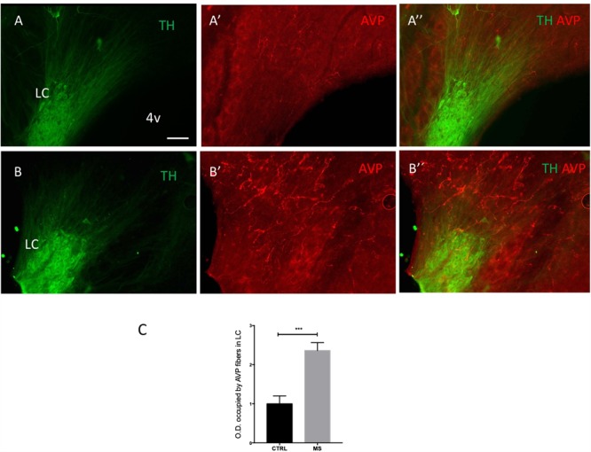 FIGURE 4