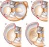 Fig. 2