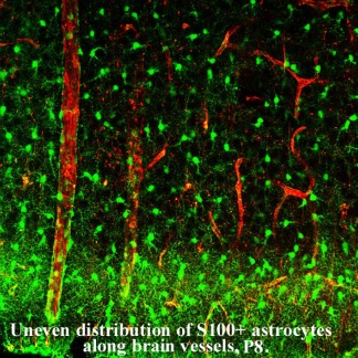 graphic file with name GLIA-61-S49-g003.jpg
