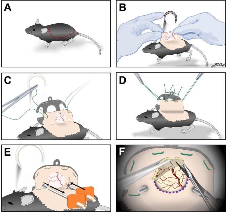 Fig 2