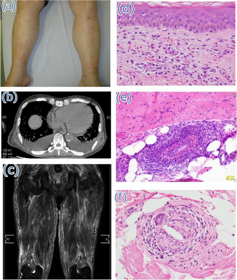 Fig. 1