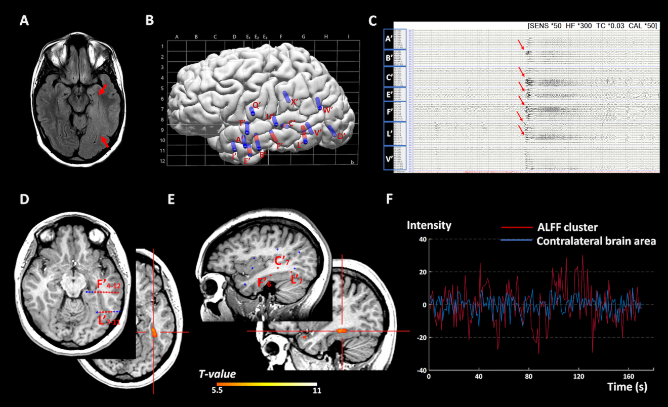 Figure 2: