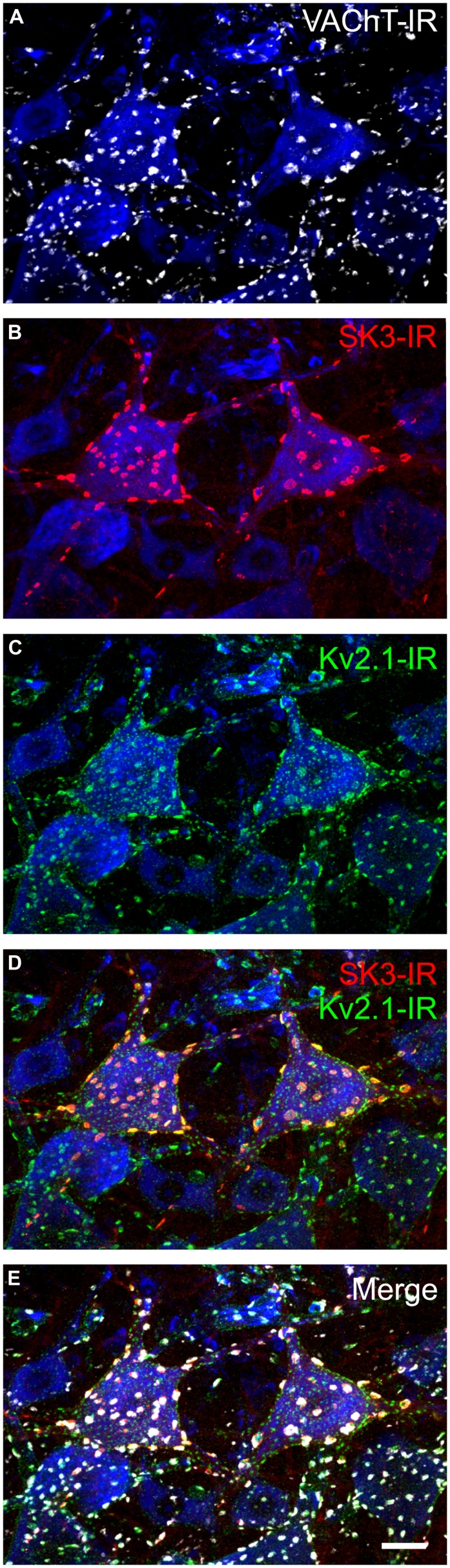 FIGURE 4