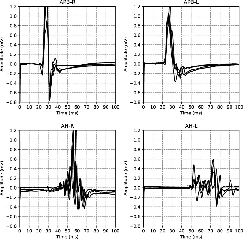 Fig. 2