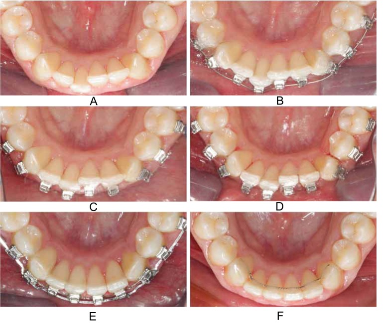 Fig. (3)