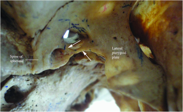 [Table/Fig-4]: