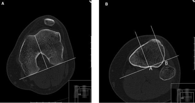 Figure 14.