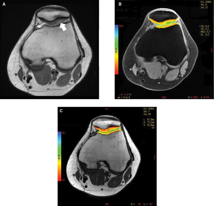 Figure 30.