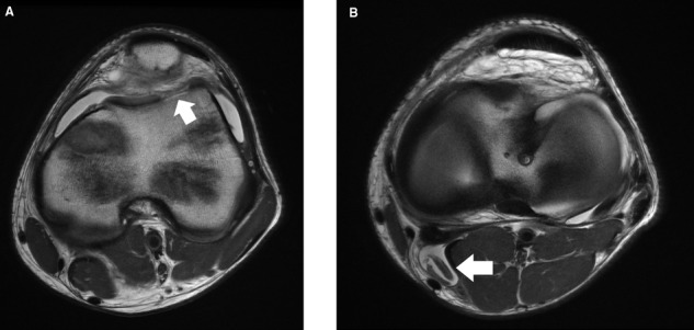 Figure 22.