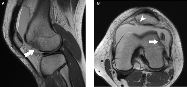 Figure 23.