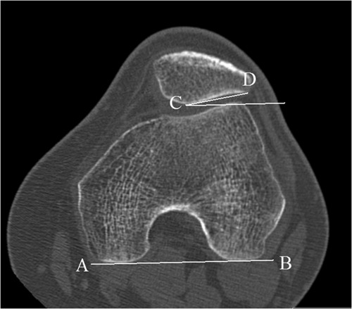 Figure 13.