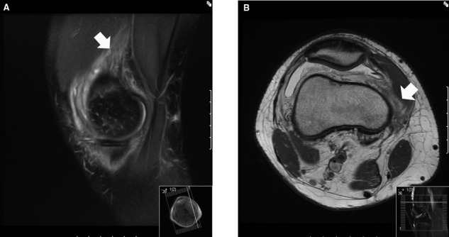 Figure 25.