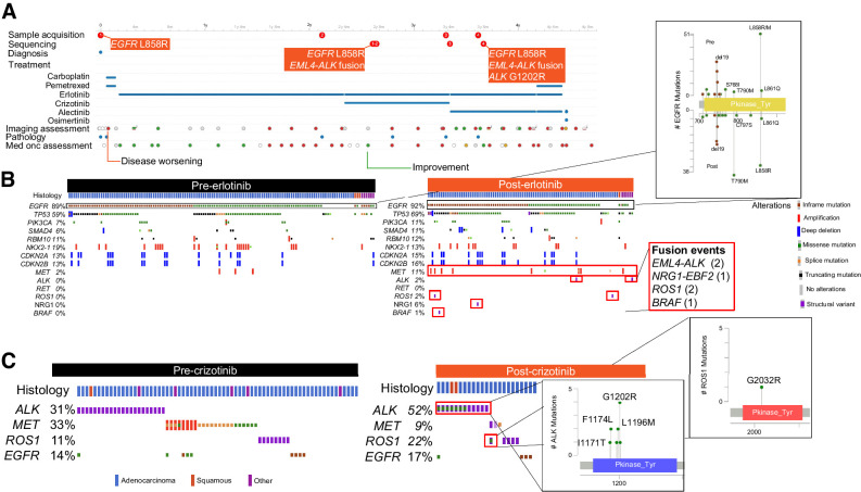 Figure 2. Dynamic genomic changes over time. A, Patient snapshot. Timeline of all samples, treatments given, imaging, pathology and medical oncology assessments are provided for each patient, allowing for facile identification of genomic evolution with sequential treatment. B, Acquired alterations post-erlotinib: Most frequent genomic alterations observed for patients before and after treatment with erlotinib are shown; lollipop plots and inset boxes highlight acquisition of known mechanisms of resistance, including second-site EGFR alterations after erlotinib treatment, acquired gene fusions and MET amplification. C, Acquired alterations post-crizotinib. Plots identifying acquisition of the analogous gatekeeper mutations ROS1 G2032RR and ALK G1202R.