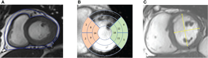 Figure 1