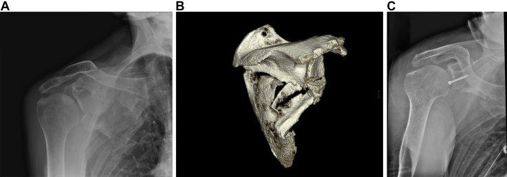 Fig 1