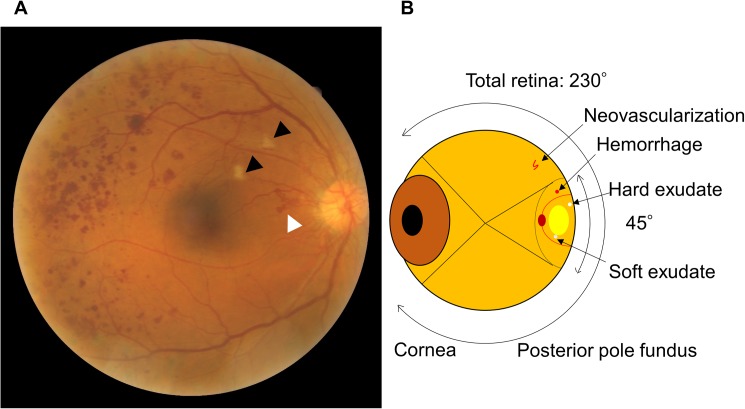 Fig 1