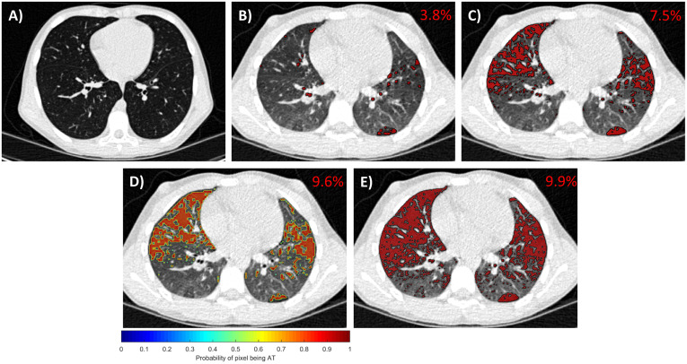 Fig 2