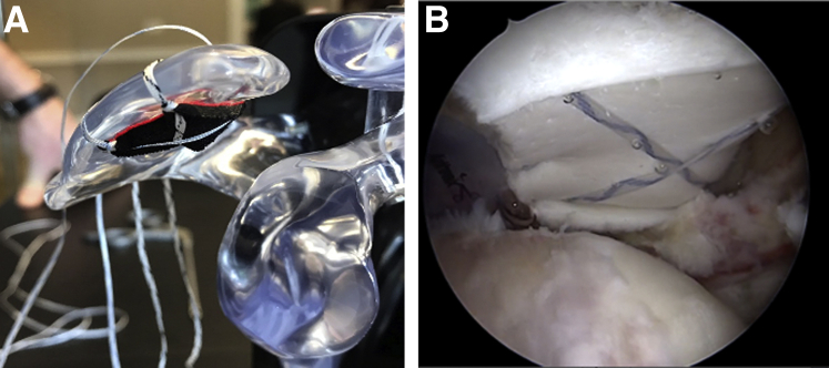 Fig 10